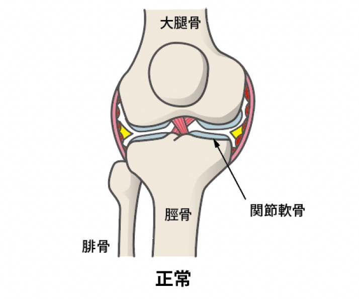 関節軟骨が正常